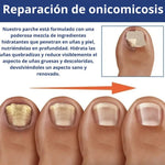Parches AntiHongos 🩹 y Regeneradores De Uñas - FUNGAL NAIL PATCHES®💊