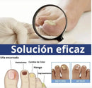 Parches AntiHongos 🩹 y Regeneradores De Uñas - FUNGAL NAIL PATCHES®💊