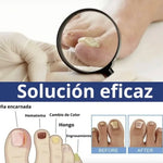 Parches AntiHongos 🩹 y Regeneradores De Uñas - FUNGAL NAIL PATCHES®💊