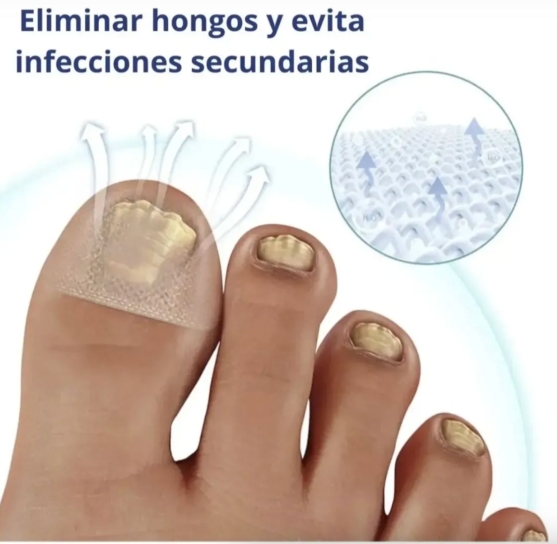 Parches AntiHongos 🩹 y Regeneradores De Uñas - FUNGAL NAIL PATCHES®💊
