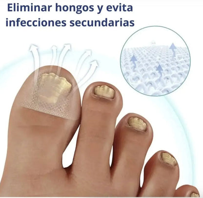 Parches AntiHongos 🩹 y Regeneradores De Uñas - FUNGAL NAIL PATCHES®💊