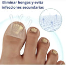 Parches AntiHongos 🩹 y Regeneradores De Uñas - FUNGAL NAIL PATCHES®💊