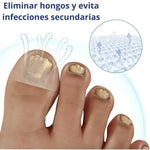 Parches AntiHongos 🩹 y Regeneradores De Uñas - FUNGAL NAIL PATCHES®💊